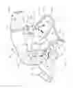 Fig. 02 - Ankle brace