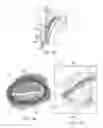 Fig. 02 - Dry eye treatment systems