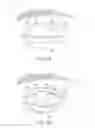 Fig. 03 - Dry eye treatment systems