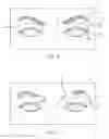 Fig. 07 - Dry eye treatment systems