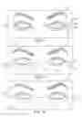 Fig. 08 - Dry eye treatment systems