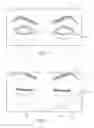 Fig. 10 - Dry eye treatment systems