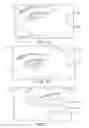 Fig. 11 - Dry eye treatment systems