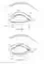 Fig. 13 - Dry eye treatment systems