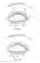 Fig. 14 - Dry eye treatment systems