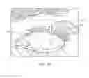 Fig. 15 - Dry eye treatment systems