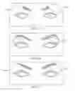 Fig. 16 - Dry eye treatment systems