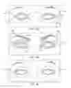 Fig. 17 - Dry eye treatment systems