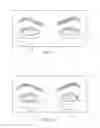 Fig. 09 - Methods for improving contact lens comfort