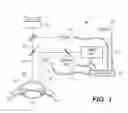 Fig. 02 - SYSTEM AND METHOD FOR REMOVING CORNEAL EPITHELIUM