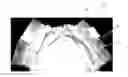 Fig. 01 - TAPED ABSORBENT ARTICLE HAVING A BELT PORTION