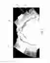 Fig. 04 - TAPED ABSORBENT ARTICLE HAVING A BELT PORTION