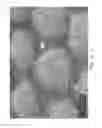 Fig. 09 - Product line of absorbent article