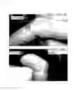 Fig. 06 - Skin Patch Instrument For Treating Pain