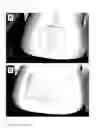 Fig. 07 - Skin Patch Instrument For Treating Pain