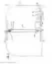 Fig. 05 - Therapeutic device for post-operative knee