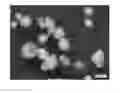Fig. 01 - Personal cleansing compositions comprising spherical perlite microspheres
