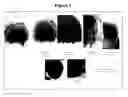 Fig. 02 - COMPOSITION FOR HAIR APPLICATION AND METHODS OF HAIR CARE