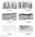 Fig. 06 - Hydrogel toxin-absorbing or binding nanoparticles