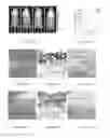Fig. 09 - Hydrogel toxin-absorbing or binding nanoparticles