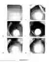 Fig. 15 - Compositions and methods for reducing overdose