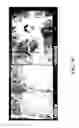 Fig. 04 - COMPOSITIONS AND METHODS FOR TREATING AND DIAGNOSING OCULAR DISORDERS