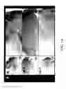 Fig. 09 - COMPOSITIONS AND METHODS FOR TREATING AND DIAGNOSING OCULAR DISORDERS