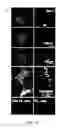 Fig. 11 - COMPOSITIONS AND METHODS FOR TREATING AND DIAGNOSING OCULAR DISORDERS