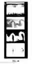 Fig. 14 - COMPOSITIONS AND METHODS FOR TREATING AND DIAGNOSING OCULAR DISORDERS