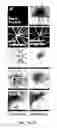 Fig. 16 - COMPOSITIONS AND METHODS FOR TREATING AND DIAGNOSING OCULAR DISORDERS