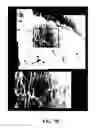 Fig. 20 - COMPOSITIONS AND METHODS FOR TREATING AND DIAGNOSING OCULAR DISORDERS