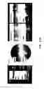 Fig. 30 - COMPOSITIONS AND METHODS FOR TREATING AND DIAGNOSING OCULAR DISORDERS