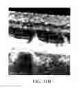 Fig. 33 - COMPOSITIONS AND METHODS FOR TREATING AND DIAGNOSING OCULAR DISORDERS