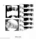 Fig. 34 - COMPOSITIONS AND METHODS FOR TREATING AND DIAGNOSING OCULAR DISORDERS