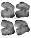 Fig. 52 - COMPOSITIONS AND METHODS FOR TREATING AND DIAGNOSING OCULAR DISORDERS