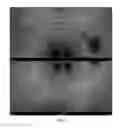 Fig. 62 - COMPOSITIONS AND METHODS FOR TREATING AND DIAGNOSING OCULAR DISORDERS