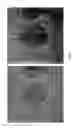 Fig. 63 - COMPOSITIONS AND METHODS FOR TREATING AND DIAGNOSING OCULAR DISORDERS