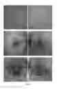 Fig. 65 - COMPOSITIONS AND METHODS FOR TREATING AND DIAGNOSING OCULAR DISORDERS