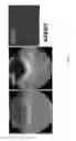 Fig. 67 - COMPOSITIONS AND METHODS FOR TREATING AND DIAGNOSING OCULAR DISORDERS