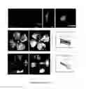 Fig. 08 - COMPOSITIONS AND METHODS FOR TREATING RETINOPATHY