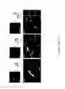 Fig. 09 - COMPOSITIONS AND METHODS FOR TREATING RETINOPATHY