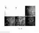 Fig. 04 - PHARMACEUTICAL COMPOSITION FOR TREATING ROTAVIRUS AND/OR RESPIRATORY SYNCYTIAL VIRUS INFECTION AND METHOD FOR PREPARING THE SAME