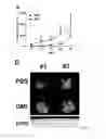 Fig. 02 - Method for treating a refractory or relapsed lung cancer