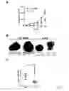 Fig. 03 - Method for treating a refractory or relapsed lung cancer