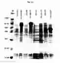 Fig. 14 - HETEROLOGOUS EXPRESSION OF NEISSERIAL PROTEINS