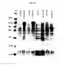 Fig. 14 - HETEROLOGOUS EXPRESSION OF NEISSERIAL PROTEINS
