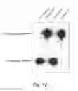 Fig. 13 - DELIVERY OF ANTIBODIES TO THE CENTRAL NERVOUS SYSTEM
