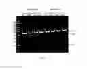 Fig. 04 - Allele selective gene editing and uses thereof