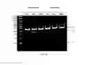 Fig. 11 - Allele selective gene editing and uses thereof
