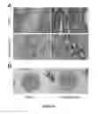 Fig. 07 - Method of binding a CSE1L tumor marker in a tumor of an animal